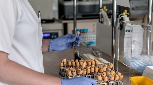 Eine Laborarbeiterin hält eine Ampulle.