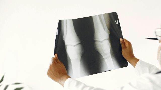 Röntgenaufnahme Knie