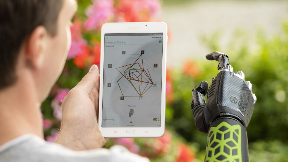 Myo Plus Musterkennung von Ottobock